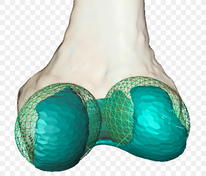 Geometry Knee Joint Condyle Femur, PNG, 1155x987px, Geometry, Aqua, Computer Servers, Condyle, Evaluation Download Free