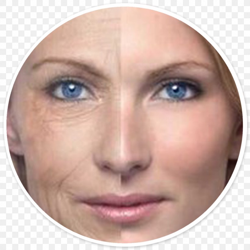 Wrinkle Medicine Skin Adult Stem Cell, PNG, 1024x1024px, Wrinkle, Adipose Tissue, Adult Stem Cell, Ageing, Cheek Download Free