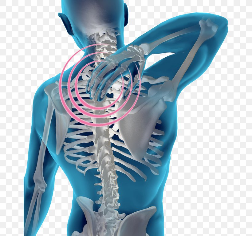 Pain In Spine Vertebral Column Human Back Cervical Vertebrae Facet Joint, PNG, 667x766px, Watercolor, Cartoon, Flower, Frame, Heart Download Free