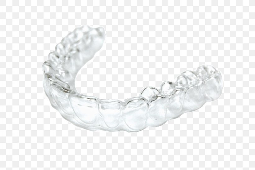 Clear Aligners Dental Braces Orthodontics Dentistry Retainer, PNG, 1024x685px, Clear Aligners, Body Jewelry, Bracelet, Bridge, Clearcorrect Download Free