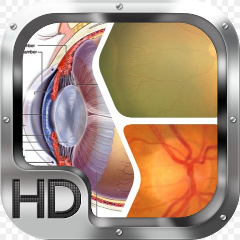 Human Eye Cataract Visual System Sense, PNG, 1024x1024px, Eye, Agy, Cataract, Eyepiece, Glaucoma Download Free