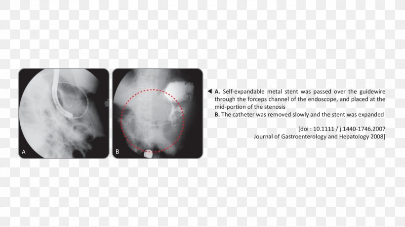 Medical Imaging Brand Magnetic Resonance Imaging Font Medicine, PNG, 1280x720px, Medical Imaging, Brand, Jaw, Joint, Magnetic Resonance Imaging Download Free