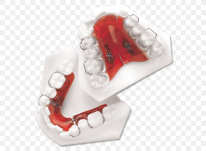 Sagittal Plane Coronal Plane Finger Distal Occlusion, PNG, 588x600px, Sagittal Plane, Coronal Plane, Dentistry, Distal, Finger Download Free