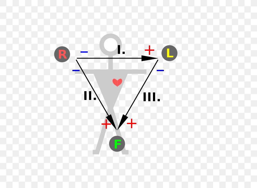 Einthoven's Triangle Electrocardiography Heart Triangolo Di Einthoven Electrode, PNG, 800x600px, Electrocardiography, Atrial Septal Defect, Brand, Cardiology, Diagram Download Free