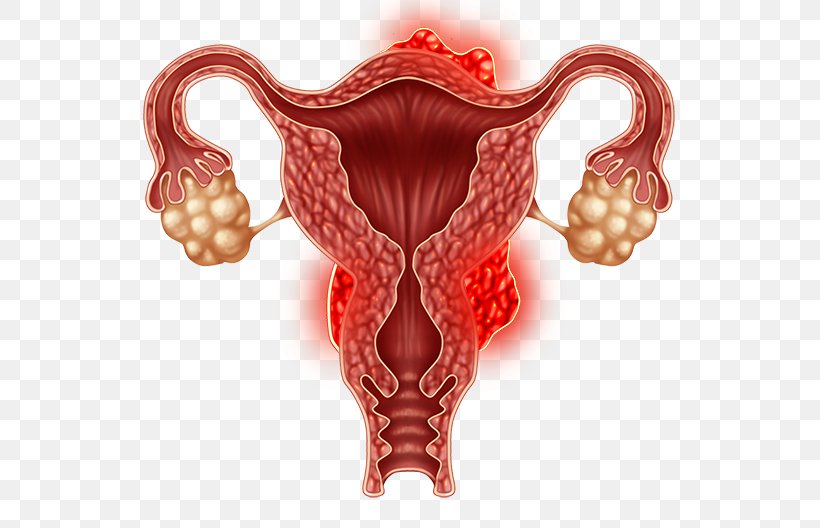 Ovary Uterine Fibroid Laparoscopy Uterus Gynaecology, PNG, 600x528px, Watercolor, Cartoon, Flower, Frame, Heart Download Free
