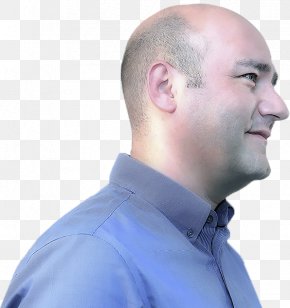 Receding Hairline Professional Appearance - Niumee Concept Esthetique Palazz L Ahmar Jaw Forehead PNG