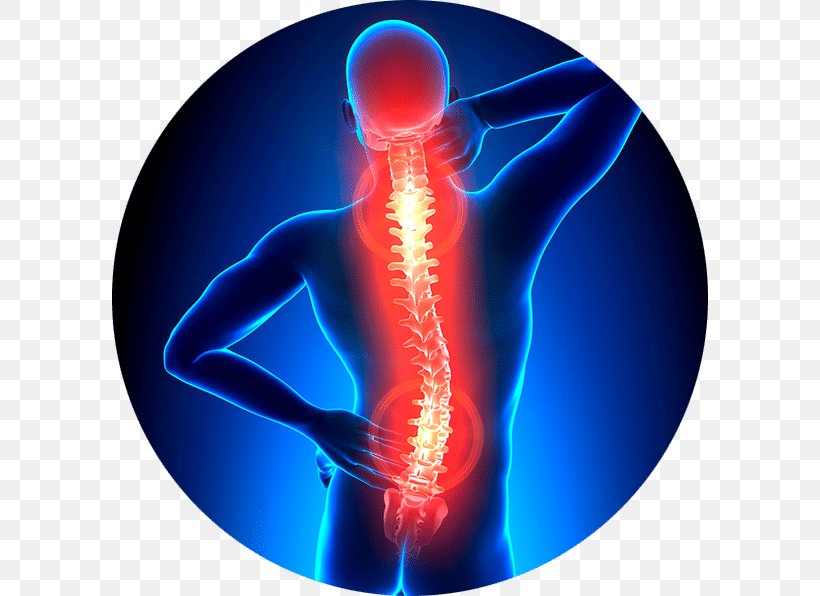 Vertebral Column Back Pain Neck Pain Physical Therapy Spinal Stenosis, PNG, 596x596px, Vertebral Column, Ache, Back Pain, Chiropractic, Chronic Pain Download Free