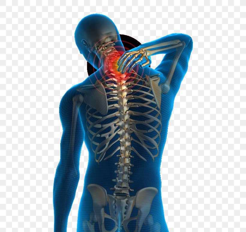 Neck Pain Low Back Pain Human Back Physical Therapy, PNG, 620x774px, Neck Pain, Ache, Back, Back Pain, Chiropractic Download Free