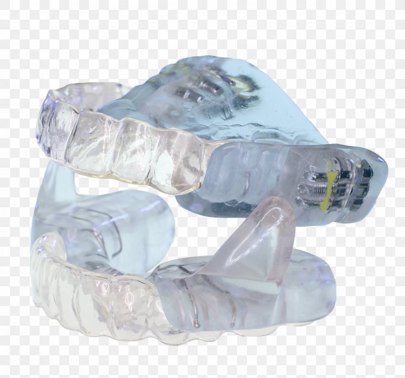 Clear Aligners Mandibular Advancement Splint Sleep Apnea Dentistry, PNG, 2500x2336px, Clear Aligners, Academy Of General Dentistry, Align Technology, Apnea, Crystal Download Free