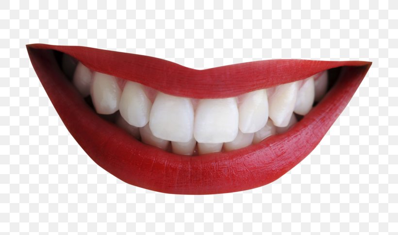 Smile Human Mouth Clip Art Human Tooth, PNG, 768x486px, Smile, Dental Braces, Emoticon, Human, Human Mouth Download Free