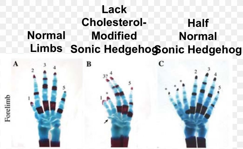 Sonic Hedgehog GLI3 Mouse Hedgehog Signaling Pathway Polydactyly, PNG, 1089x671px, Watercolor, Cartoon, Flower, Frame, Heart Download Free