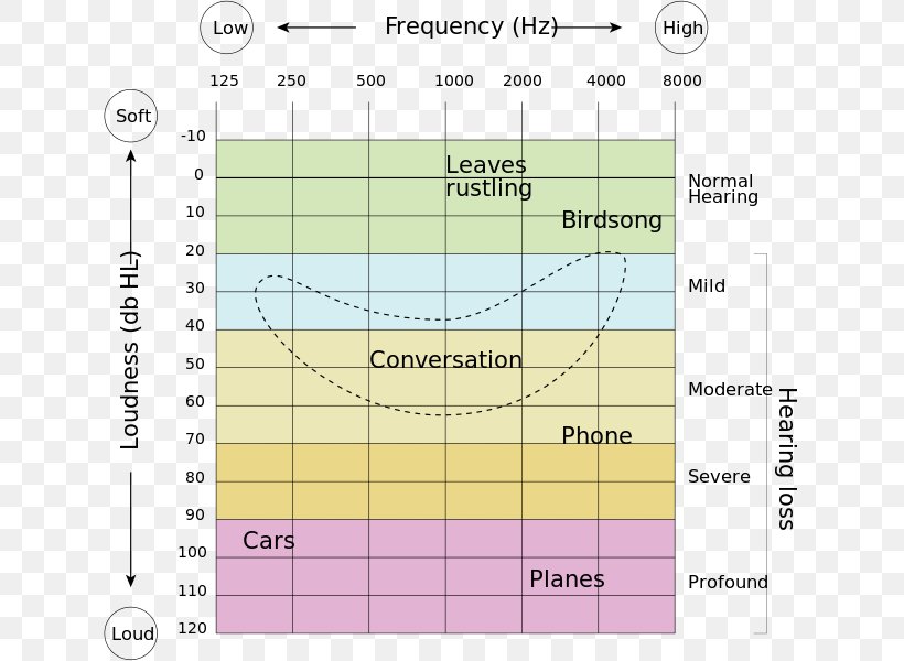 Hearing Loss Hearing Range Hearing Test Audiogram, PNG, 632x600px, Hearing, Area, Audio Frequency, Audiogram, Audiology Download Free