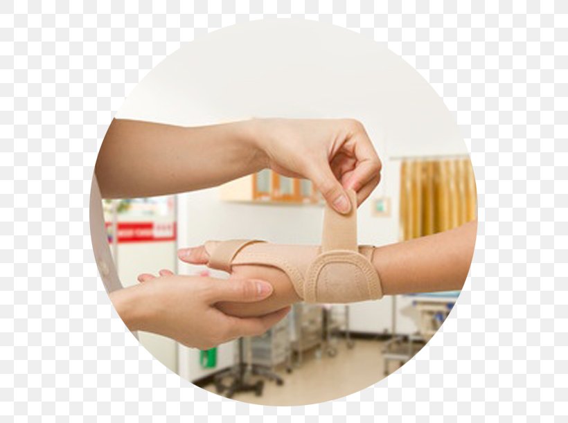 Physical Therapy Physical Medicine And Rehabilitation Stock Photography, PNG, 586x611px, Physical Therapy, Arm, Carpal Tunnel, Carpal Tunnel Syndrome, Finger Download Free