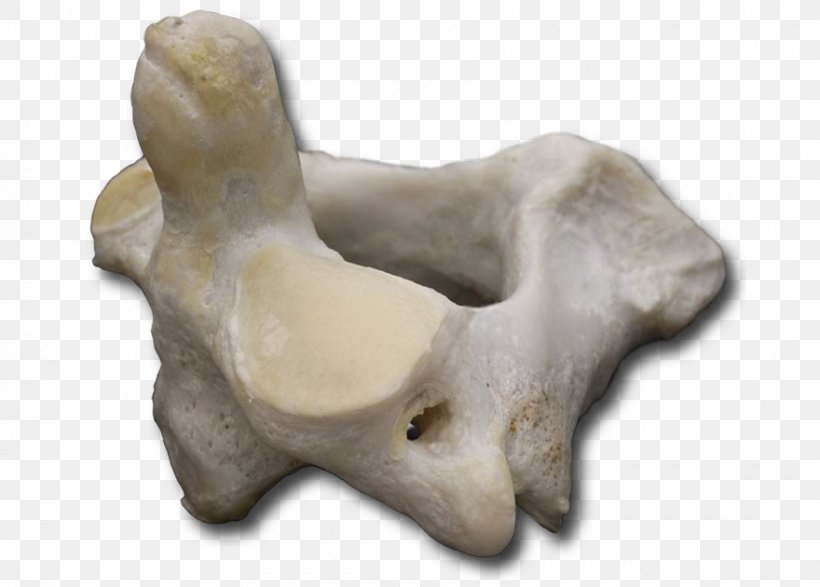 Bone Atlas Sculpture Vertebral Column VH Dissector, PNG, 880x630px, Bone, Anatomy, Artifact, Atlas, Carving Download Free