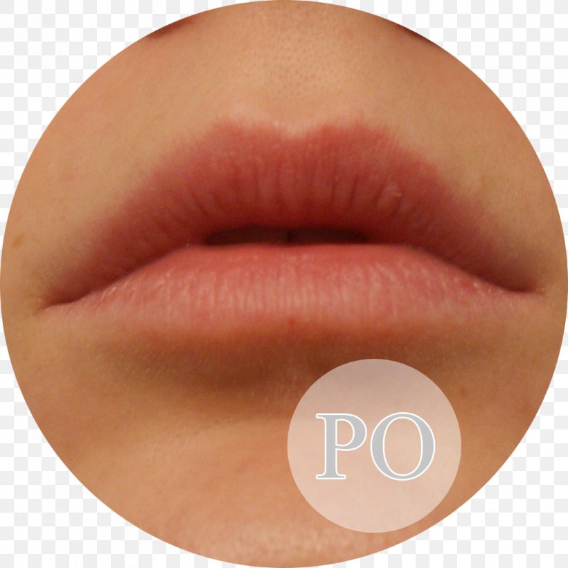 Lip Gloss Lipstick Eyelash Peach, PNG, 1032x1032px, Lip Gloss, Cheek, Chin, Close Up, Cosmetics Download Free