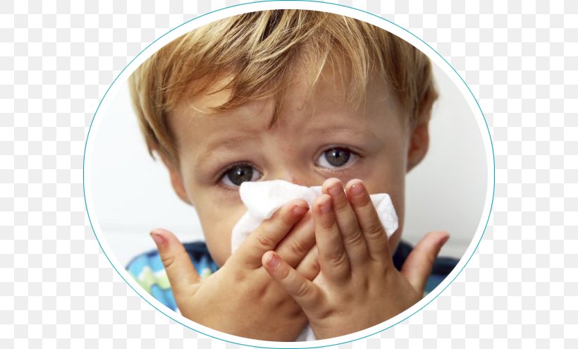 Rhinitis Hay Fever Allergy Child Rhinorrhea, PNG, 584x495px, Rhinitis, Allergy, Cheek, Child, Chin Download Free