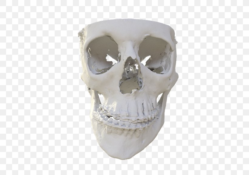 Skull MedCAD Surgery Skeleton Patient, PNG, 576x576px, 3d Computer Graphics, 3d Modeling, Skull, Bone, Clinic Download Free