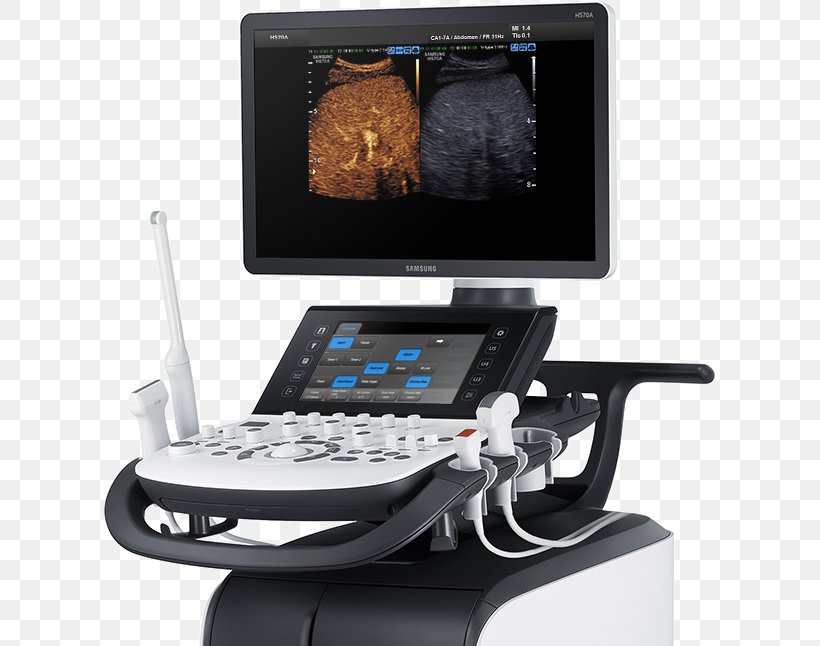 Ultrasonography Ultrasound Samsung Radiology Medicine, PNG, 613x646px, Ultrasonography, Display Device, Electronic Instrument, Electronics, Gynaecology Download Free