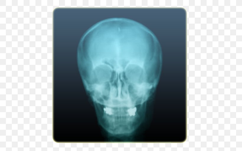 X-Ray Camera Girls Joke Android X-ray Vision, PNG, 512x512px, Xray, Android, App Store, Bone, Camera Download Free