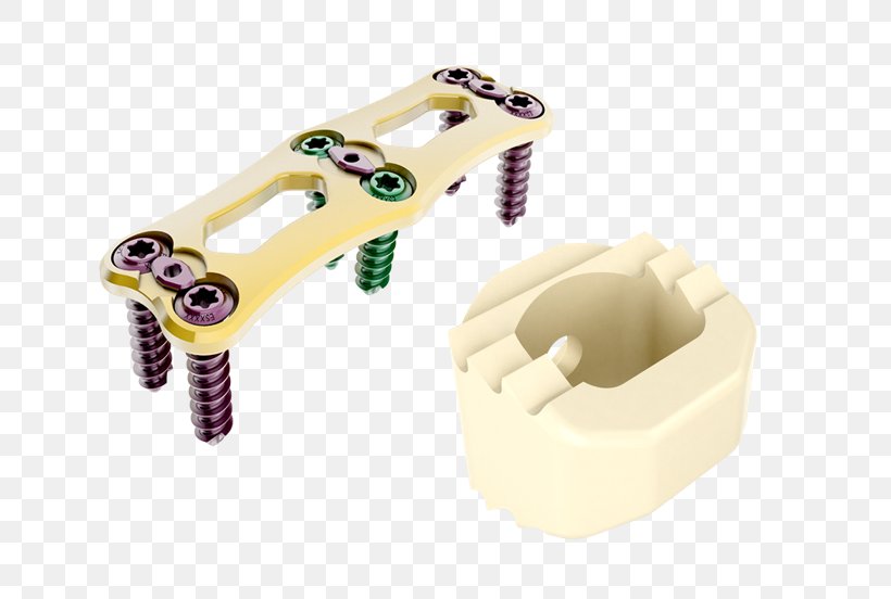 Cervical Vertebrae Implant Vertebral Column Spinal Cord Stimulator, PNG, 801x552px, Cervical Vertebrae, Ceramic, Hardware, Implant, Intervertebral Disc Arthroplasty Download Free