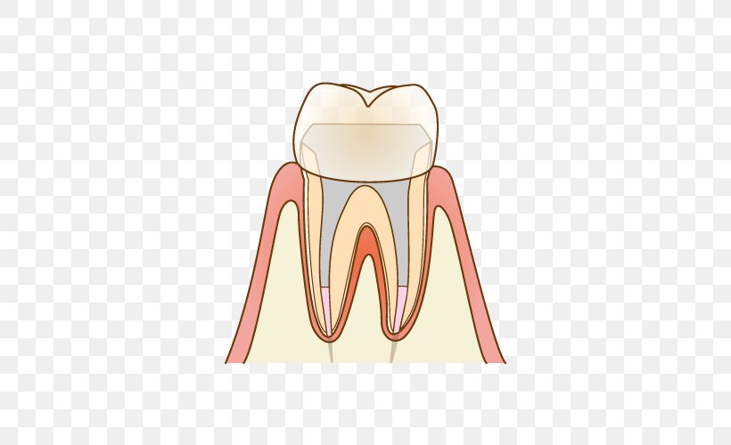 歯科 Dentist Root Canal Therapy Tooth Decay, PNG, 500x500px, Watercolor, Cartoon, Flower, Frame, Heart Download Free