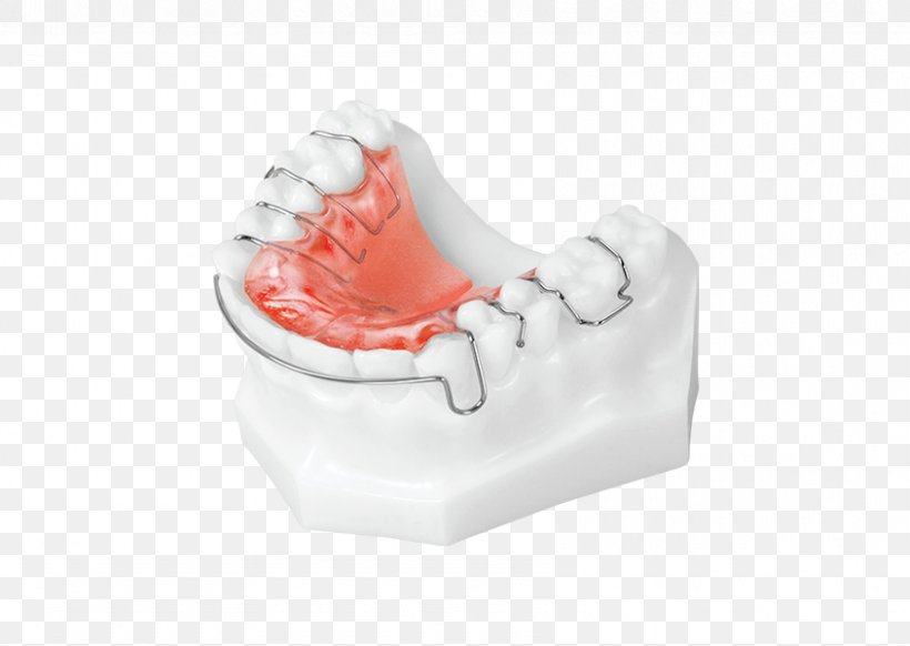 Tooth Plastic, PNG, 845x600px, Tooth, Jaw, Mouth, Outdoor Shoe, Plastic Download Free