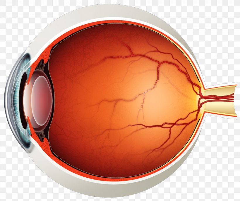 Retinal Detachment Posterior Vitreous Detachment Mydriasis Symptom, PNG, 984x824px, Retinal Detachment, Disease, Eye, Floater, Human Eye Download Free