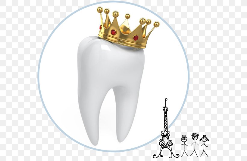 Crown Dentistry Human Tooth, PNG, 585x536px, Watercolor, Cartoon, Flower, Frame, Heart Download Free