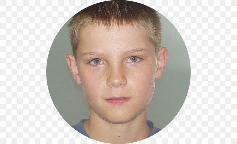 Eyebrow Dyslexia Child Actor Cheek, PNG, 500x500px, Eyebrow, Boy, Cheek, Child, Child Actor Download Free