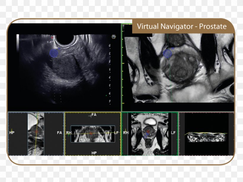 Ultrasonography Magnetic Resonance Imaging Esaote Medical Imaging Medical Equipment, PNG, 1200x900px, Ultrasonography, Academisch Ziekenhuis, Brand, Esaote, Harmonic Download Free