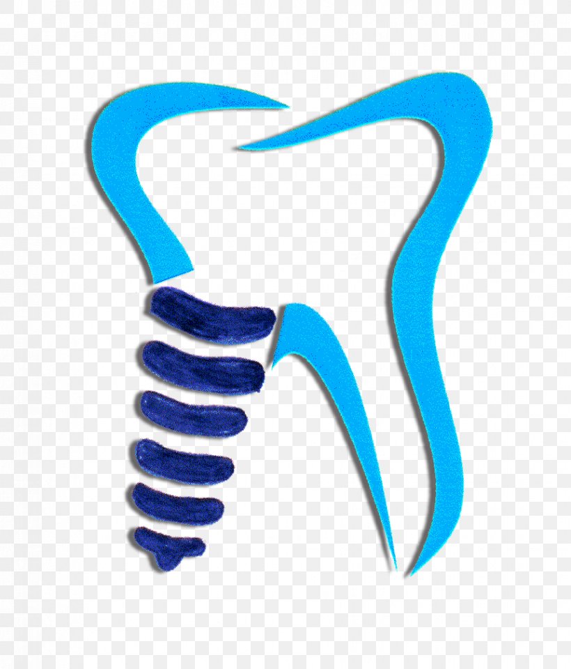 Dentistry Dental Implant Tooth Share A Smile Clinic Png