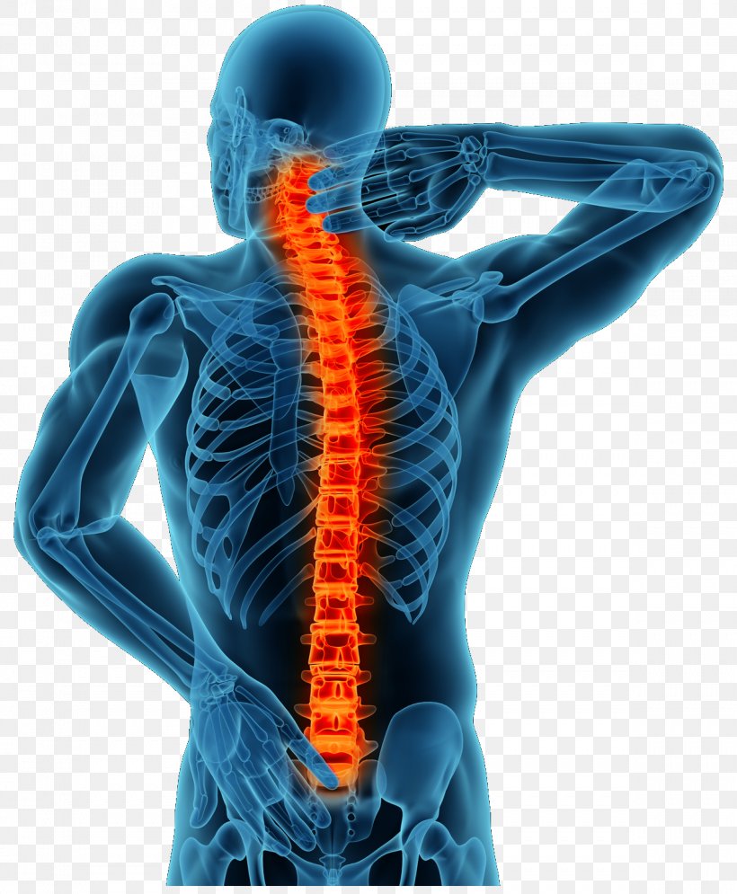 Back Pain Pain Management Therapy Spinal Disc Herniation Degenerative Disc Disease, PNG, 1189x1444px, Back Pain, Chronic Pain, Degenerative Disc Disease, Disease, Electric Blue Download Free