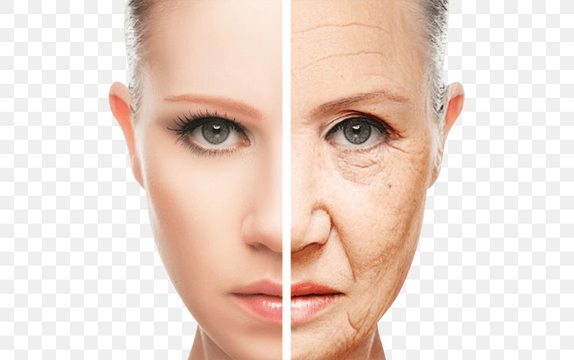 Wrinkle Skin Ageing Cosmetics Anti-aging Cream, PNG, 575x515px, Wrinkle, Ageing, Antiaging Cream, Beauty, Cheek Download Free