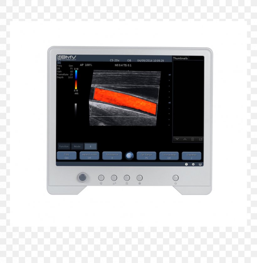 Display Device Ultrasonography Laptop Computer Monitors Ultrasound, PNG, 977x1000px, Display Device, Computer Hardware, Computer Monitors, Cordless, Electronic Device Download Free