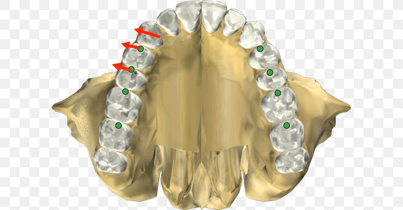 Jaw, PNG, 609x427px, Jaw Download Free