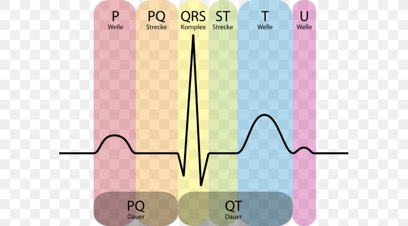 Electrocardiography Heart Cardiology Systole QRS Complex, PNG, 581x454px, Watercolor, Cartoon, Flower, Frame, Heart Download Free