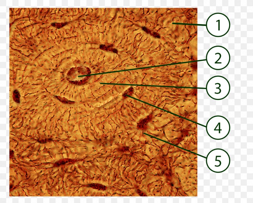 Osteocyte Connective Tissue Lacuna Bone Osteon, PNG, 1000x800px, Osteocyte, Beenweefsel, Bone, Cell, Compact Bot Download Free