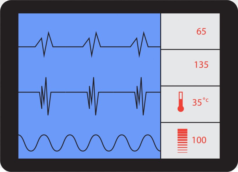 Electrocardiography Heart Rate Icon, PNG, 1594x1153px, Electrocardiography,  Animation, Area, Brand, Cartoon Download Free