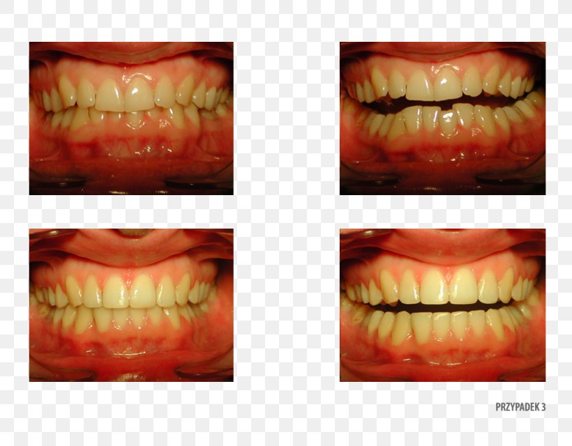 Orange Polska Close-up Therapy Patient, PNG, 1024x800px, Orange, Chin, Close Up, Closeup, Jaw Download Free