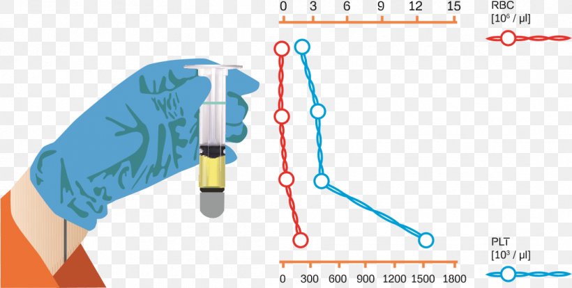 Technology Line Angle, PNG, 1094x553px, Technology, Area, Diagram, Hand, Joint Download Free