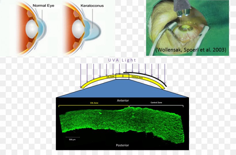 Biomechanics Organism Tissue Dental Implant, PNG, 950x625px, Biomechanics, Communication Protocol, Crosslink, Dental Implant, Eye Download Free