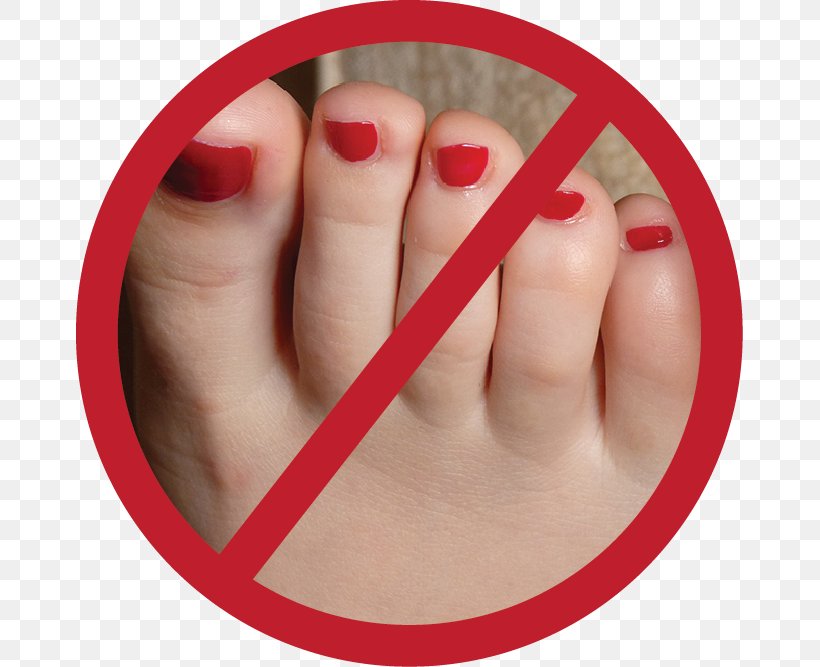 Nail Toe Foot Shoe Insert, PNG, 667x667px, Nail, Feet, Finger, Foot, Hammer Toe Download Free
