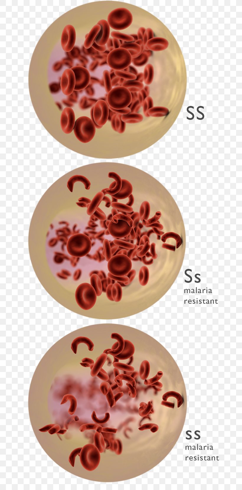 Codominance Sickle Cell Disease Sickle Cell Trait Genetic Disorder, PNG, 704x1660px, Dominance, Allele, Autosome, Codominance, Flavor Download Free