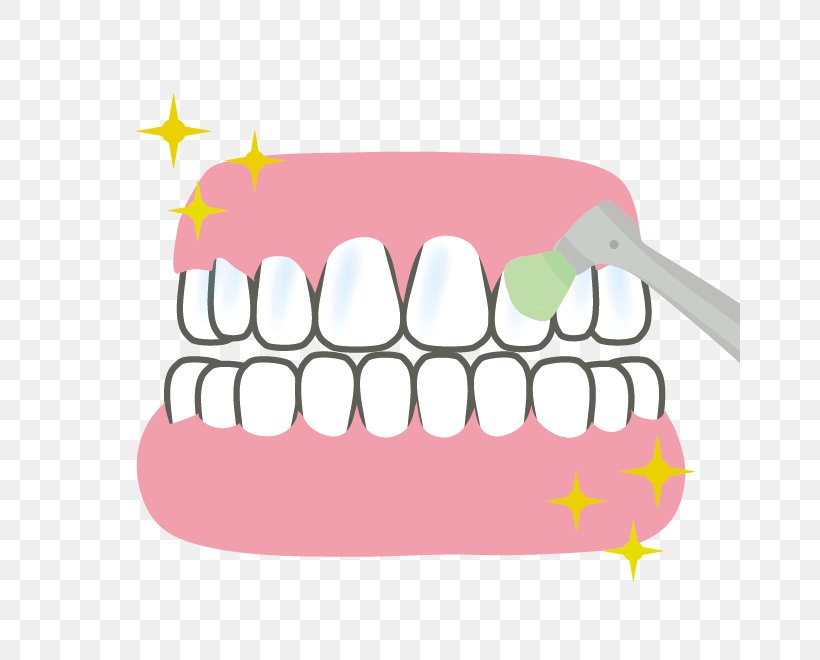 Tooth Dentures Dentist 歯科 Dental Plaque, PNG, 660x660px, Watercolor, Cartoon, Flower, Frame, Heart Download Free