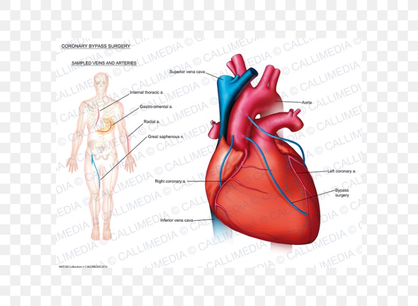 Heart Disease: A Textbook Of Cardiovascular Medicine Anatomy Coronary Artery Disease Cardiology, PNG, 600x600px, Watercolor, Cartoon, Flower, Frame, Heart Download Free