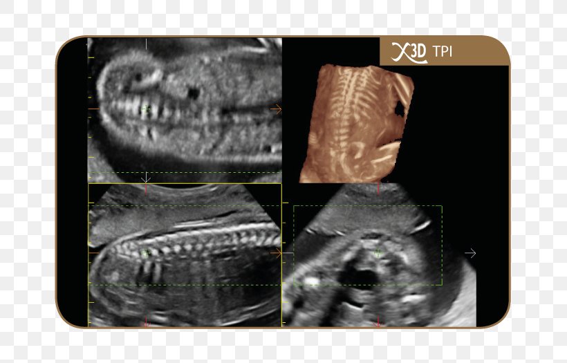 Ultrasonography Esaote Medical Equipment Technology Magnetic Resonance Imaging, PNG, 700x525px, Ultrasonography, Business, Esaote, Image Processing, Italy Download Free