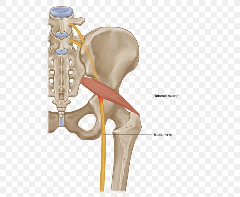 Piriformis Syndrome Piriformis Muscle Back Pain Injection Surgery, PNG, 520x673px, Watercolor, Cartoon, Flower, Frame, Heart Download Free