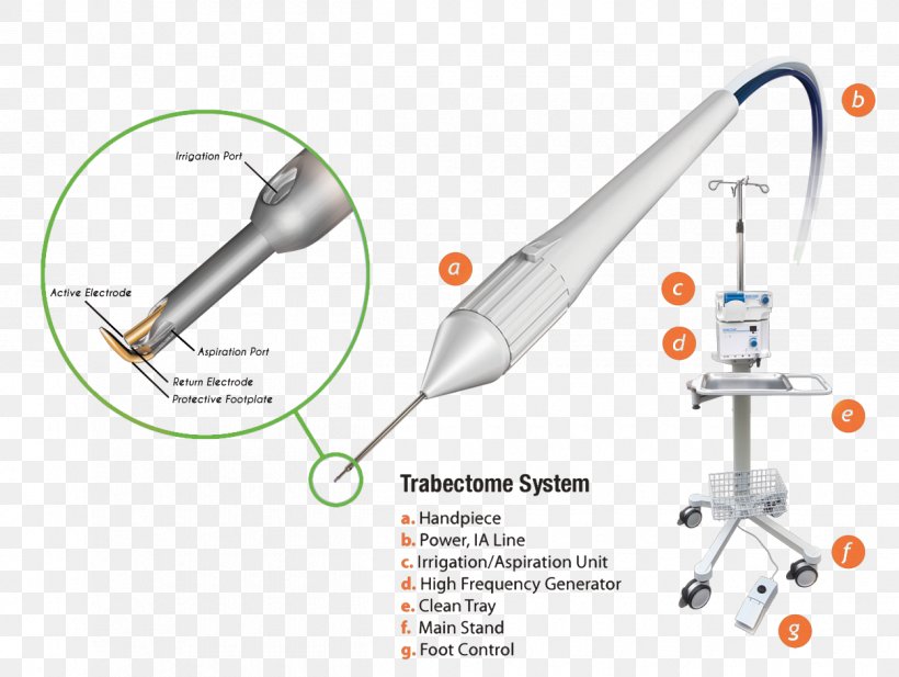 Trabectome Glaucoma Surgery Ophthalmology Glaucoma Surgery, PNG, 1250x941px, Surgery, Blindness, Dysphagia, Glaucoma, Glaucoma Surgery Download Free