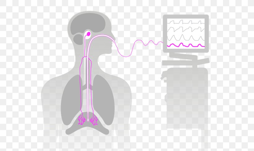 Neurally Adjusted Ventilatory Assist Mechanical Ventilation Catheter Medical Ventilator Maquet, PNG, 782x488px, Watercolor, Cartoon, Flower, Frame, Heart Download Free