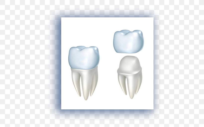 Crown Dentistry Dental Restoration Dental Implant, PNG, 512x512px, Watercolor, Cartoon, Flower, Frame, Heart Download Free